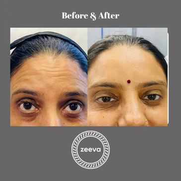 Slider image (4) Zeeva Skin & Hair Clinic